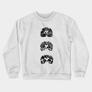 Alzheimer's Disease Crewneck Sweatshirt